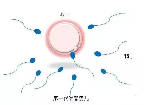 42岁PGT成功案例